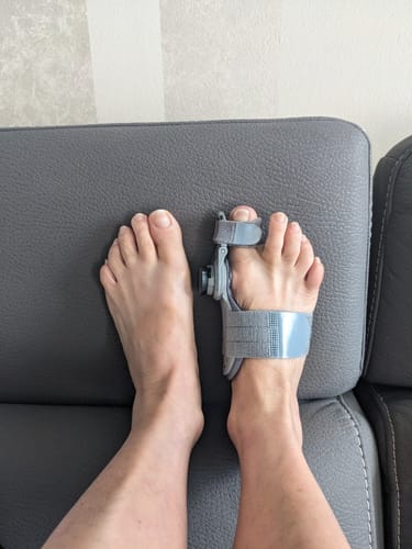 My bunions are very severe. I’m at the point of requiring surgery. I have had them for 45 years. I now have severe hammertoes. I doubted the product but I was willing to try because of the 90 day guarantee.
After two uses, I am noticing significant stretching in tendons and muscles. This device is intelligently designed and comfortable to wear. I find I can already walk in them for short distances while wearing while relaxing. I feel I will be able to wear to bed soon as well. I’m hoping that ...
